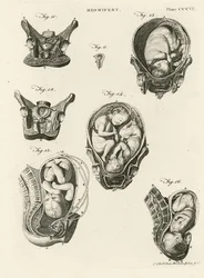 Ostetricia, illustrazione da 